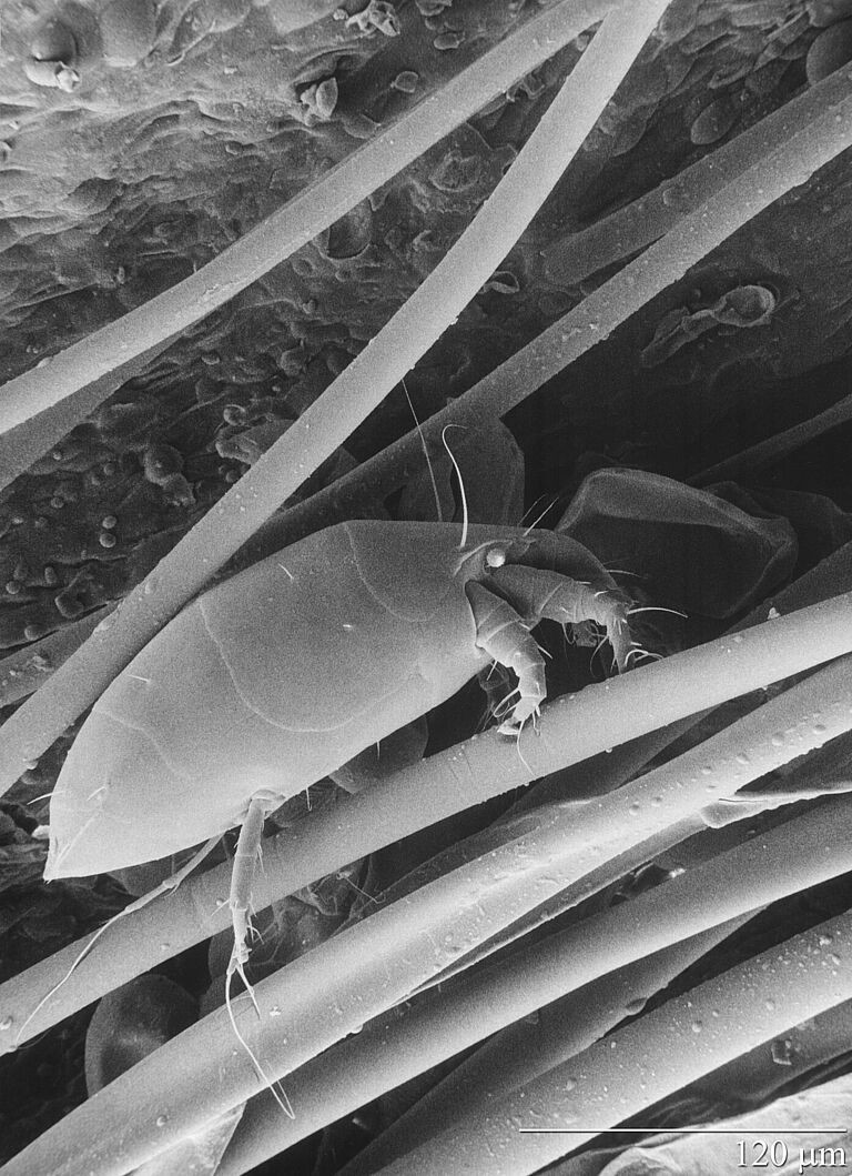 Microscopic image of the Strawberry mite Phytonemus pallidus